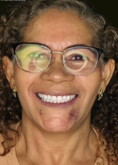 Depois da Carga Imediata - Dr. Lucas Lopes